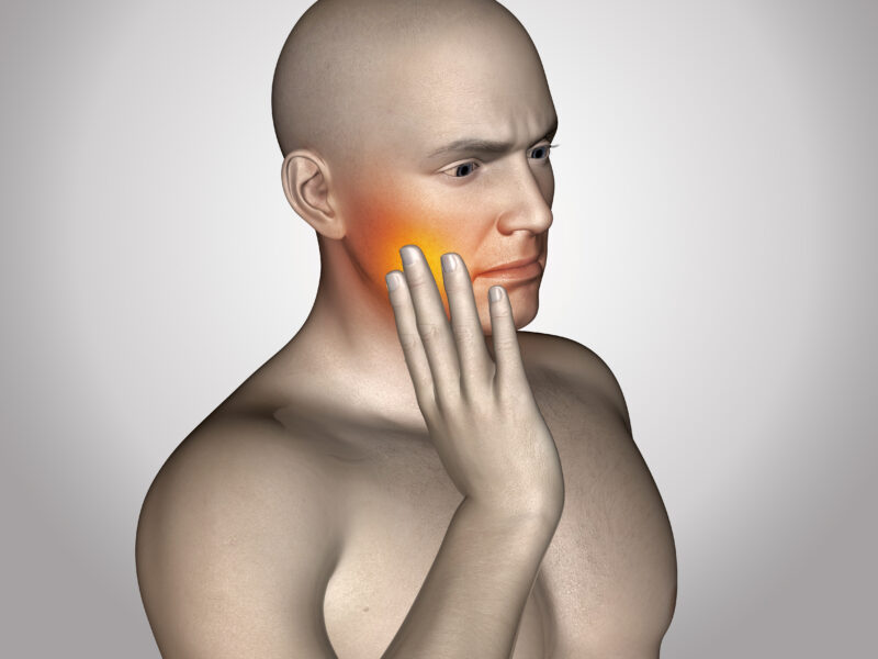 frattura dello zigomo