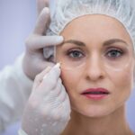 lifting mini invasivo